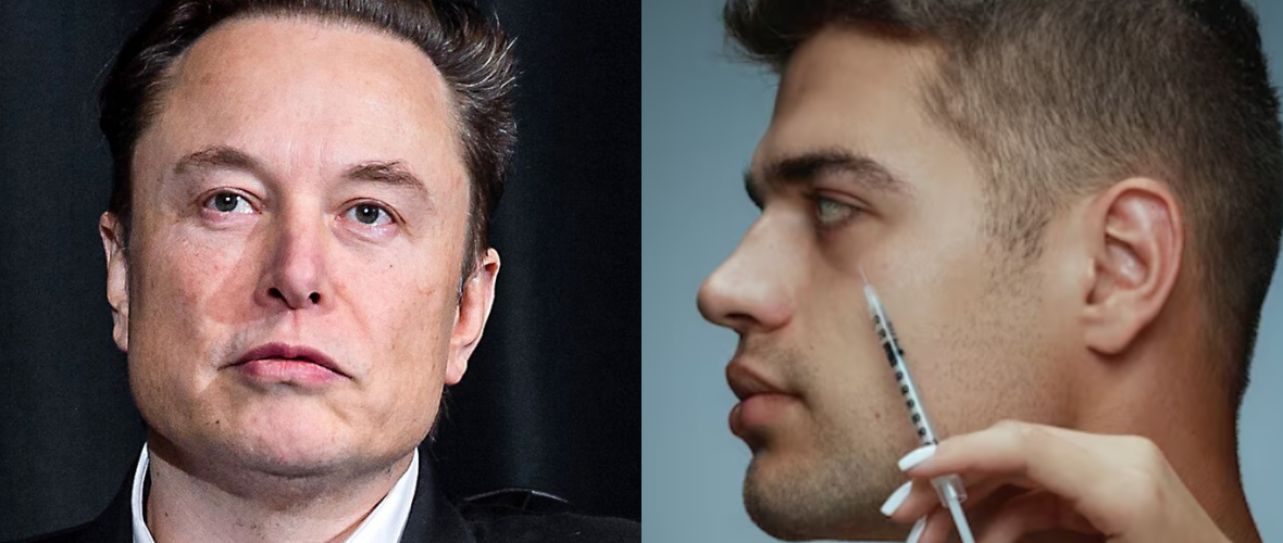 From Natural Boy to Plastic Perfect Man: Has Musk Had Plastic Surgery?